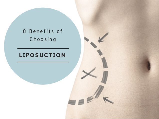 8 Benefits of Choosing Liposuction - Grossman Capraro