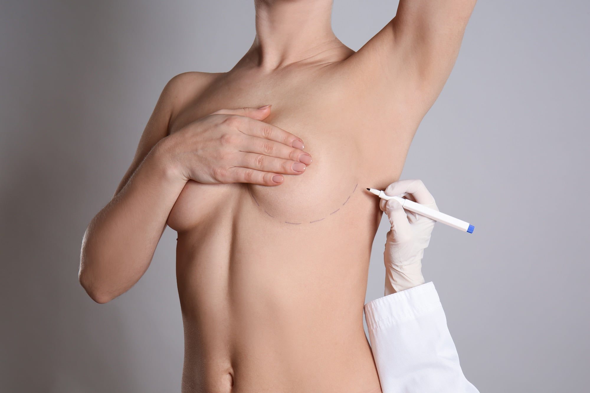 Breast prosthesis - Breast Form - breast prosthetic - Denver, Colorado