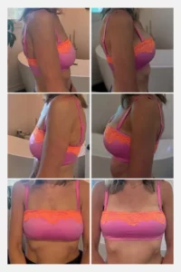 Grossman Capraro Plastic Surgery