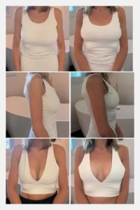 Grossman Capraro Plastic Surgery