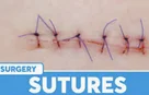 Grossman Capraro Plastic Surgery