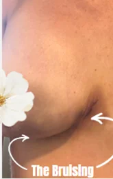 Grossman Capraro Plastic Surgery