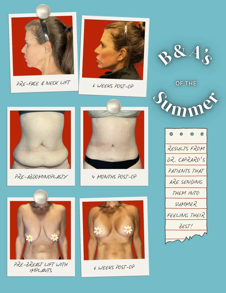 Grossman Capraro Plastic Surgery