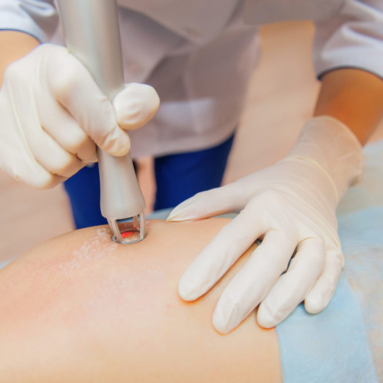 Laser Skin Resurfacing in Denver, Greenwood Village, CO & Beverly Hills, CA