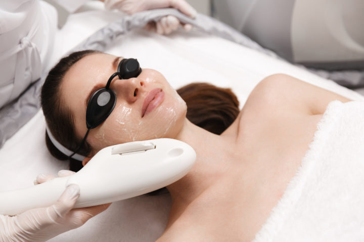 IPL Photofacial Treatment in Denver & Greenwood Village, CO