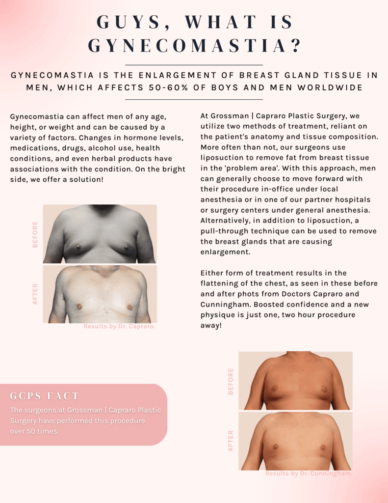 Guys, What is Gynecomastia