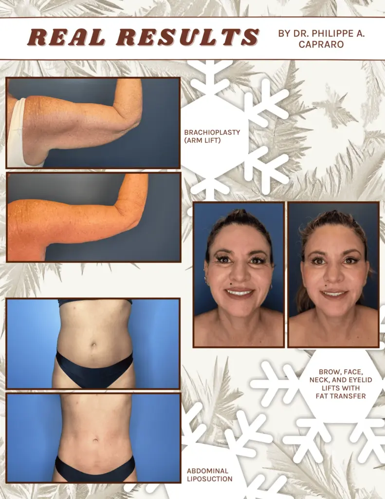 Winter Glow Ups: Why Winter Is Ideal for Laser Treatments
